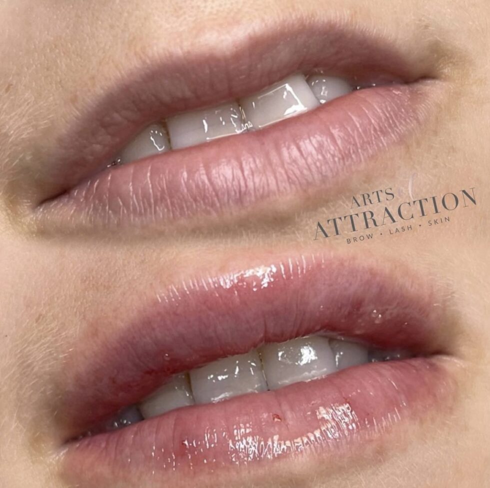 Hyaluronic Lip Infusion Arts of Attraction