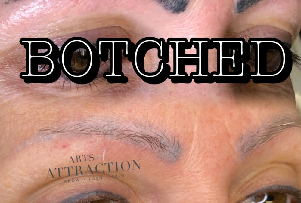 Tattoo/permanent Makeup Removal – 24 Hour Critical Period!