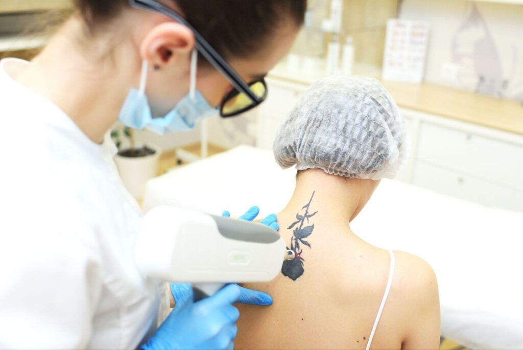 Technician using a laser device to remove a floral tattoo from a woman's neck.