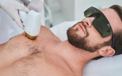 Getting Ready for Laser Hair Removal: A Simple Guide