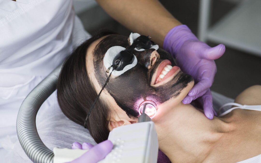 Woman smiling during carbon laser facial treatment, wearing protective goggles and receiving laser application over charcoal mask.