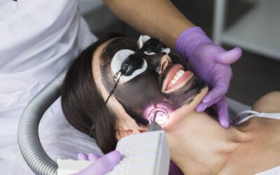 Why Carbon Laser Facials Are Summer’s Best Kept Skin Secret