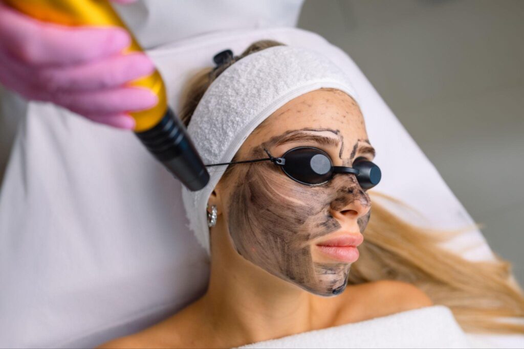 Carbon facial session in progress with close-up of woman’s face covered in carbon mask as laser device is applied.